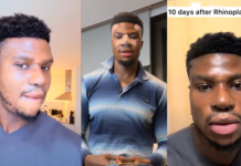 “I was constantly ridiculed”-Nigerian skit maker (Zicsaloma) discloses his reason for nose surgery