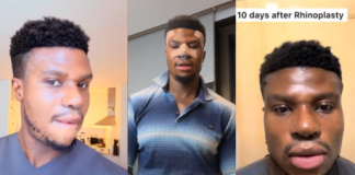 “I was constantly ridiculed”-Nigerian skit maker (Zicsaloma) discloses his reason for nose surgery